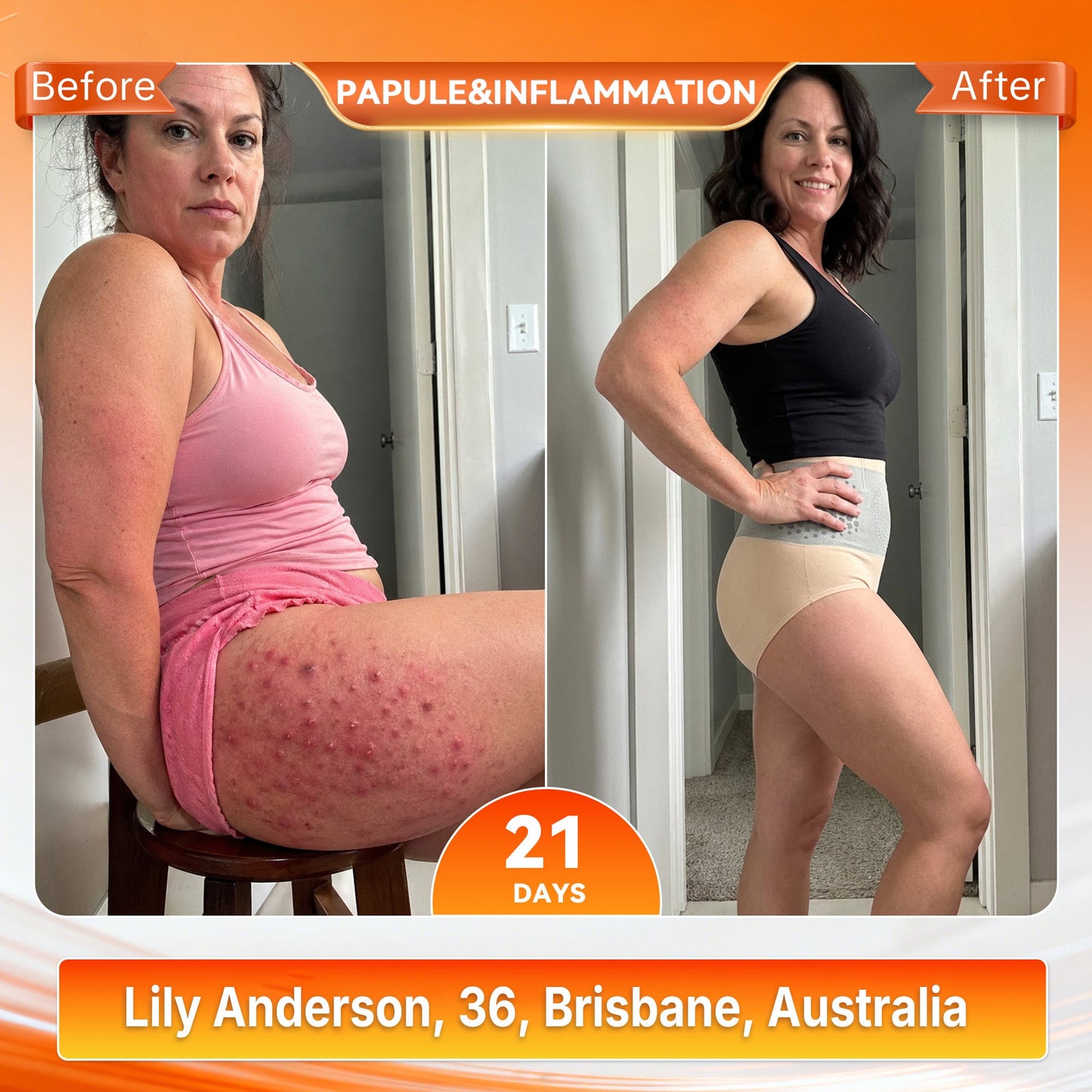 𝐎𝐟𝐟𝐢𝐜𝐢𝐚𝐥 𝐁𝐫𝐚𝐧𝐝 𝐒𝐭𝐨𝐫𝐞 🎁 𝑨𝑳𝑳𝒀𝑩𝑬𝑬® 𝟐𝟎𝟐𝟔 𝐌𝐨𝐫𝐢𝐧𝐠𝐚 & 𝐁𝐞𝐫𝐛𝐞𝐫𝐢𝐧𝐞 𝟒-𝐈𝐧-𝟏 𝐌𝐢𝐜𝐫𝐨-𝐏𝐚𝐫𝐭𝐢𝐜𝐥𝐞 𝐒𝐜𝐮𝐥𝐩𝐭𝐢𝐧𝐠 & 𝐅𝐚𝐭-𝐁𝐮𝐫𝐧 𝐒𝐡𝐨𝐫𝐭𝐬